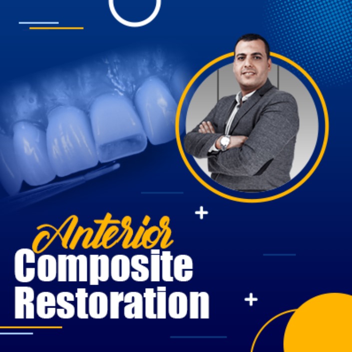 Anterior Composite Restorations