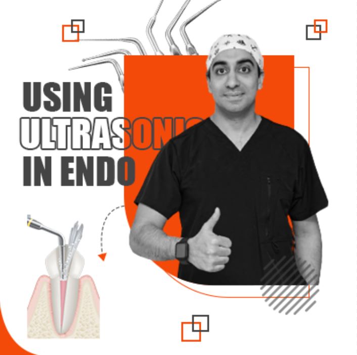 Using Ultrasonics In Endo