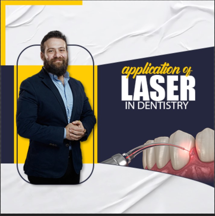 Application Of Laser In Dentistry