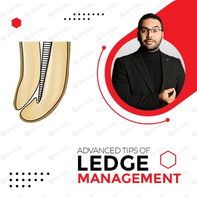 Advanced Tips Of Ledge Management