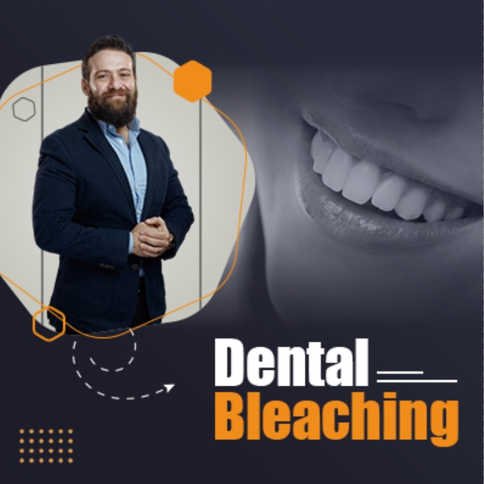 Dental Bleaching