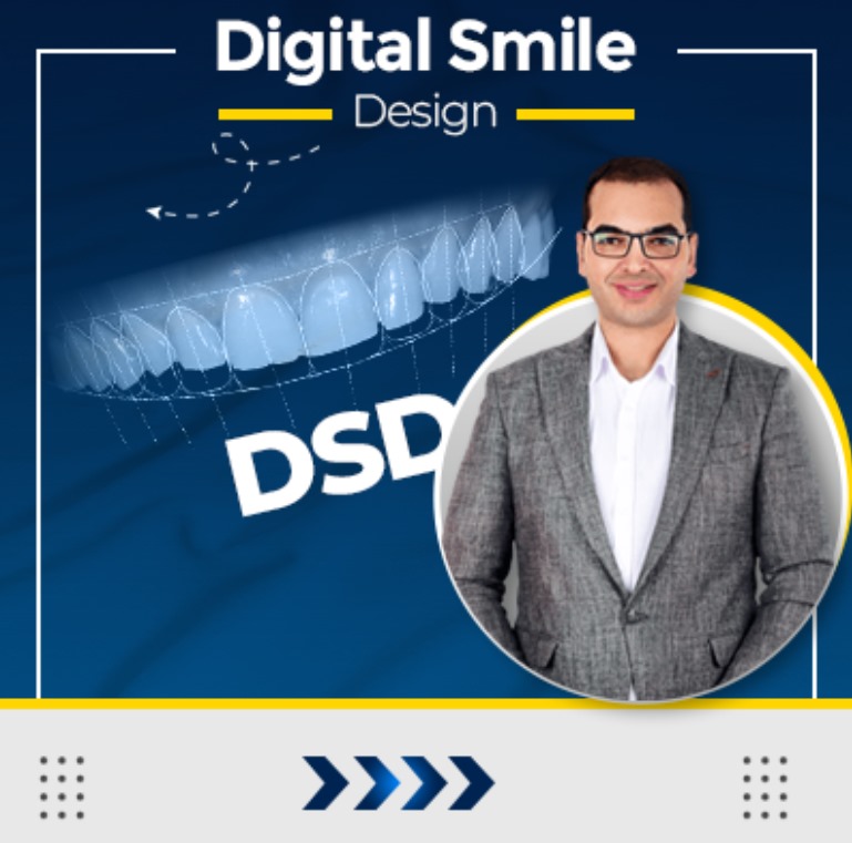 Digital Smile Designs (DSD)